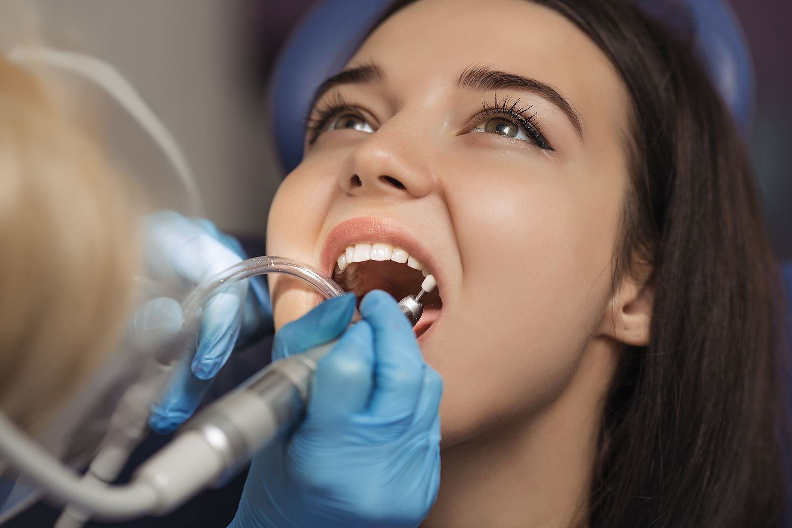 What to Expect During a General Dentistry Checkup: A Comprehensive Guide